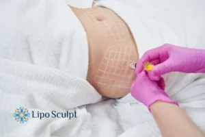 Are The Results From Aqualyx Permanent? 1 Do you want to know how long Aqualyx Hertford results last?