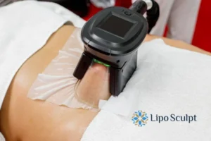 Does Fat Freezing At Home Work? 3 Fat freezing at home from Lipo Sculpt Hertford